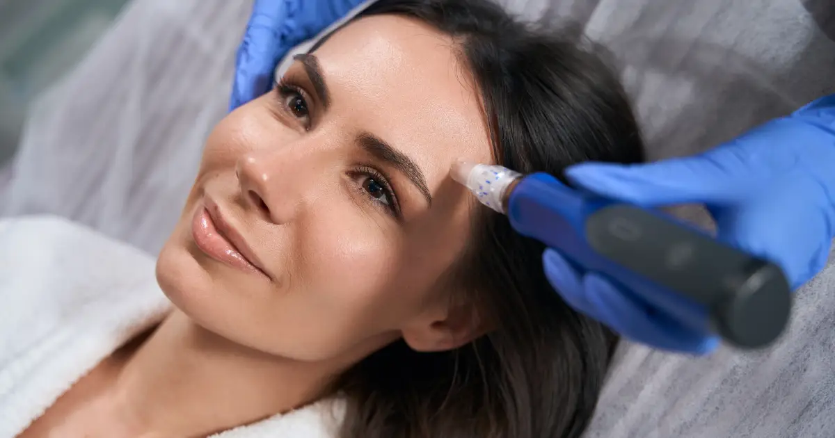 Microneedling facial treatment for woman at skincare clinic in Clearwater FL