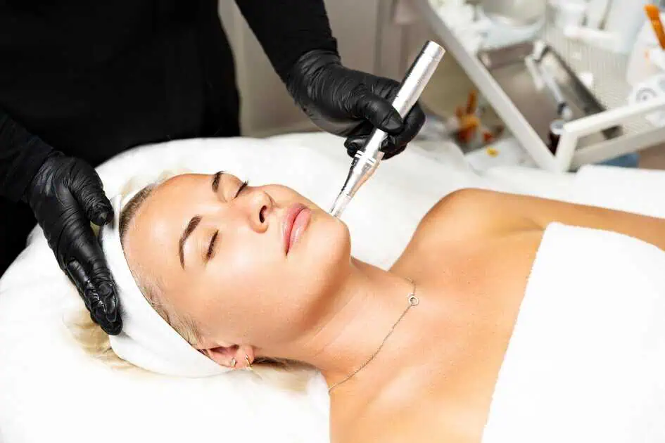 Is Microneedling Safe? What You Need to Know